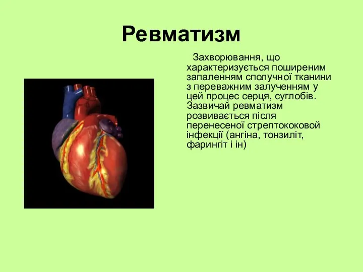 Ревматизм Захворювання, що характеризується поширеним запаленням сполучної тканини з переважним залученням у