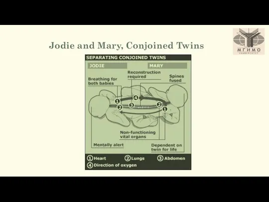 Jodie and Mary, Conjoined Twins