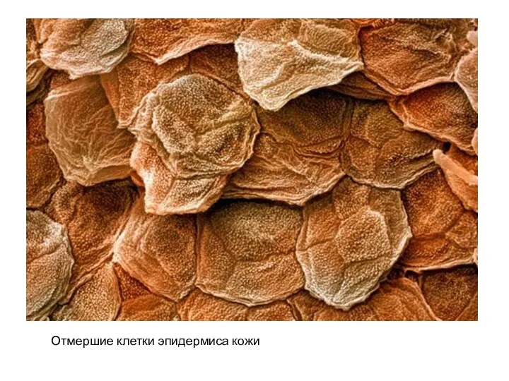 Отмершие клетки эпидермиса кожи
