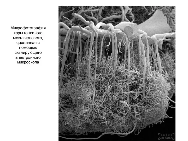 Микрофотография коры головного мозга человека, сделанная с помощью сканирующего электронного микроскопа