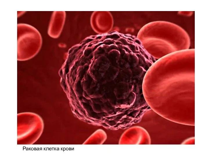 Раковая клетка крови