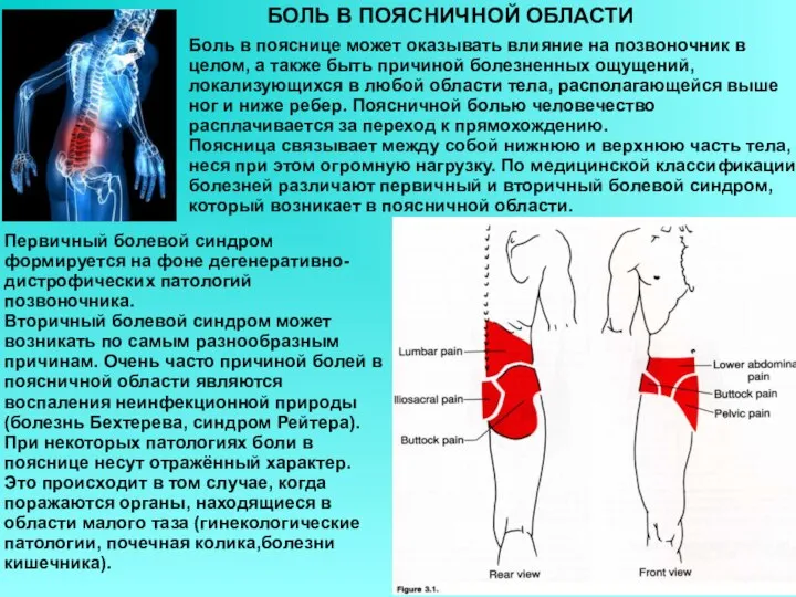 БОЛЬ В ПОЯСНИЧНОЙ ОБЛАСТИ Боль в пояснице может оказывать влияние на позвоночник