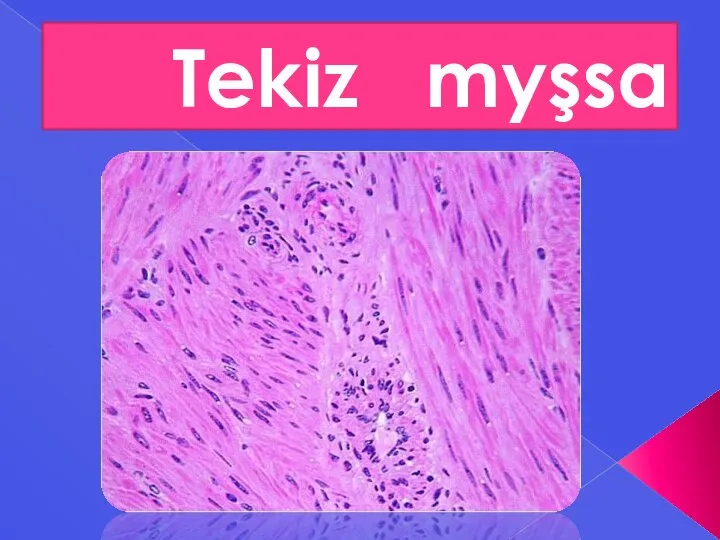 Tekiz myşsa