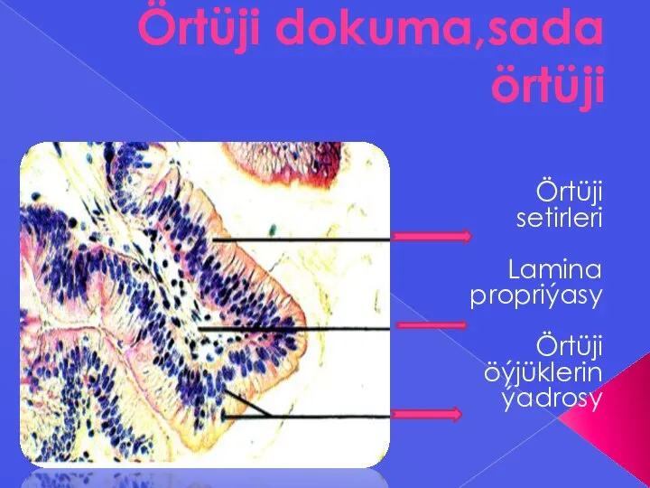 Örtüji dokuma,sada örtüji Örtüji setirleri Lamina propriýasy Örtüji öýjüklerin ýadrosy