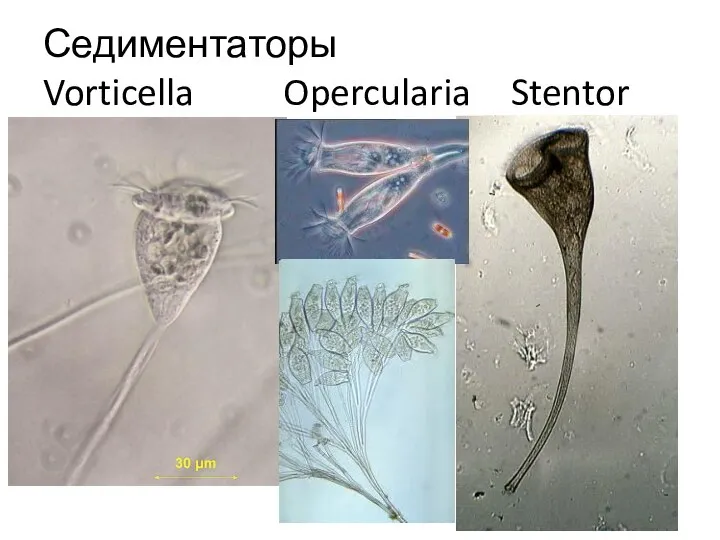 Седиментаторы Vorticella Opercularia Stentor