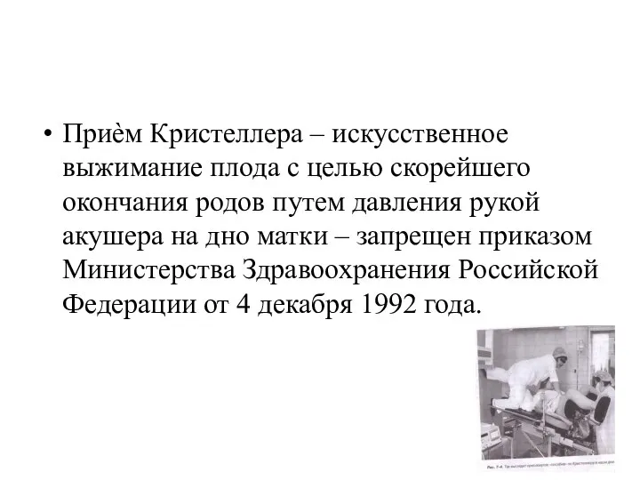 Приѐм Кристеллера – искусственное выжимание плода с целью скорейшего окончания родов путем