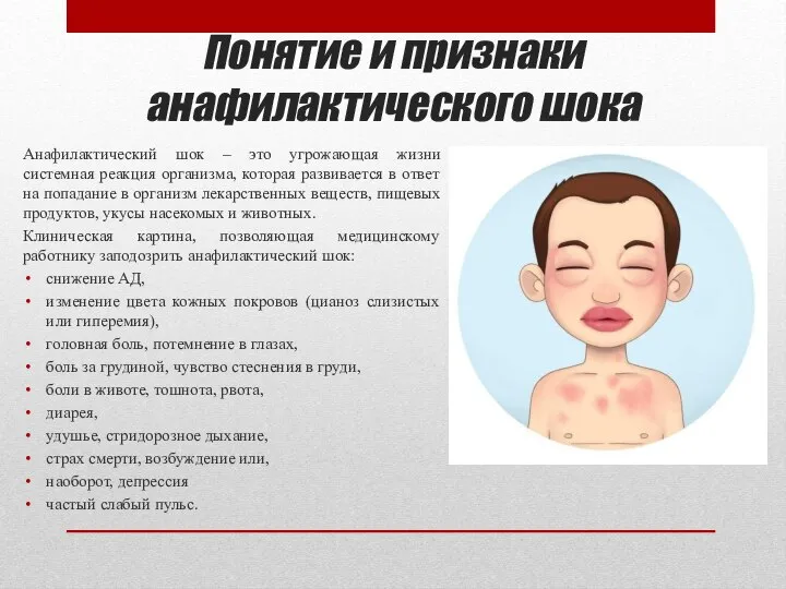 Понятие и признаки анафилактического шока Анафилактический шок – это угрожающая жизни системная