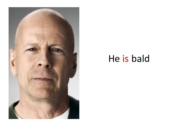 He is bald