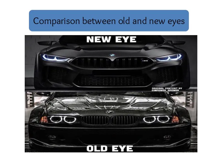 Comparison between old and new eyes Comparison between old and new eyes