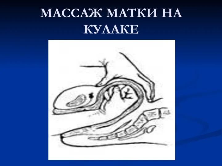 МАССАЖ МАТКИ НА КУЛАКЕ