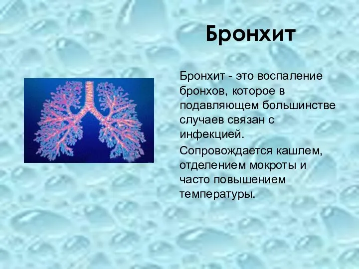 Бронхит Бронхит - это воспаление бронхов, которое в подавляющем большинстве случаев связан