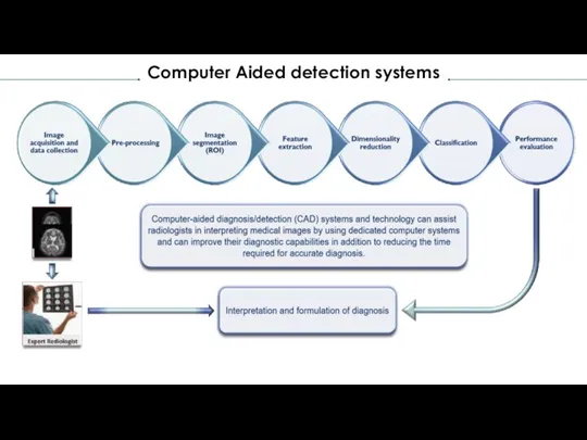 Computer Aided detection systems