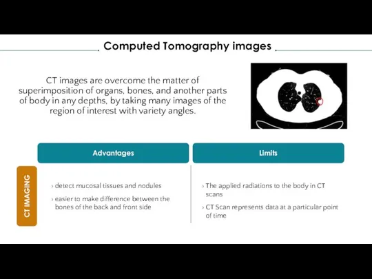 CT images are overcome the matter of superimposition of organs, bones, and