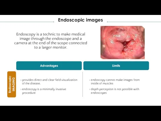 Endoscopy is a technic to make medical image through the endoscope and