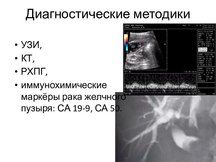 Диагностические методики УЗИ, КТ, РХПГ, иммунохимические маркёры рака желчного пузыря: СА 19-9, СА 50.