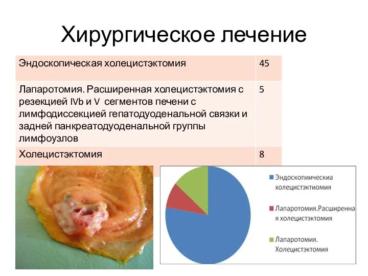 Хирургическое лечение