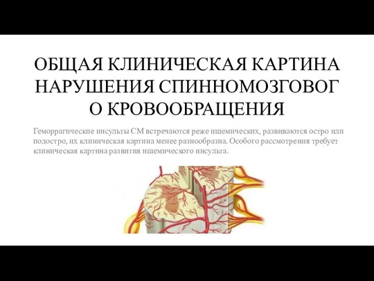 ОБЩАЯ КЛИНИЧЕСКАЯ КАРТИНА НАРУШЕНИЯ СПИННОМОЗГОВОГО КРОВООБРАЩЕНИЯ Геморрагические инсульты СМ встречаются реже ишемических,