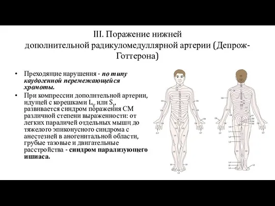 III. Поражение нижней дополнительной радикуломедуллярной артерии (Депрож-Готтерона) Преходящие нарушения - по типу