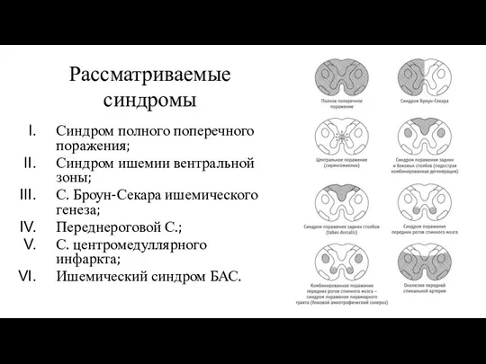 Рассматриваемые синдромы Синдром полного поперечного поражения; Синдром ишемии вентральной зоны; С. Броун-Секара