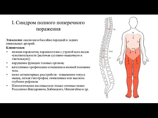 I. Синдром полного поперечного поражения Этиология: окклюзия в бассейне передней и задних