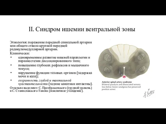 II. Синдром ишемии вентральной зоны Этиология: поражение передней спинальной артерии или общего