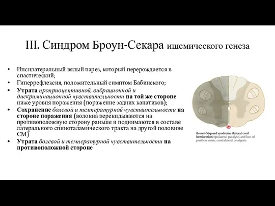 III. Синдром Броун-Секара ишемического генеза Ипсилатеральный вялый парез, который перерождается в спастический;