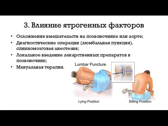 3. Влияние ятрогенных факторов Осложнения вмешательств на позвоночнике или аорте; Диагностические операции