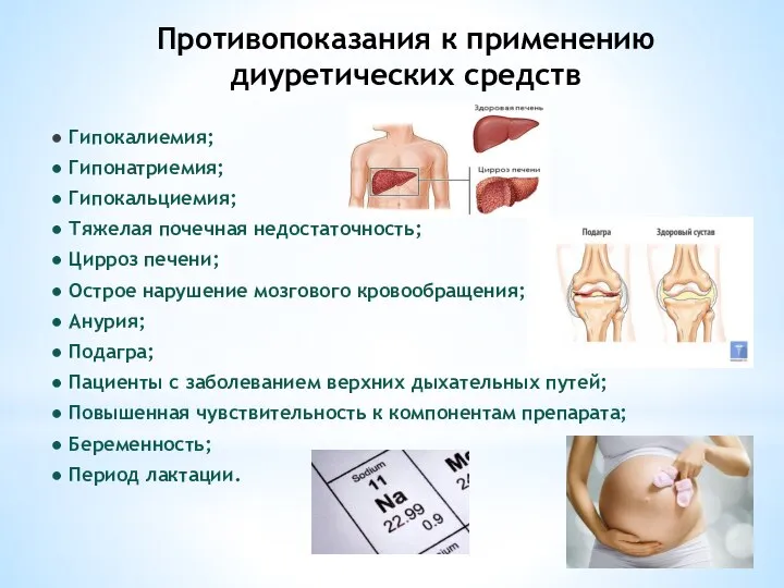 Противопоказания к применению диуретических средств ● Гипокалиемия; ● Гипонатриемия; ● Гипокальциемия; ●