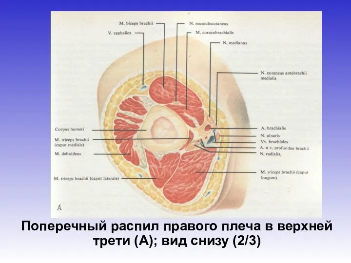 Поперечный распил правого плеча в верхней трети (А); вид снизу (2/3)