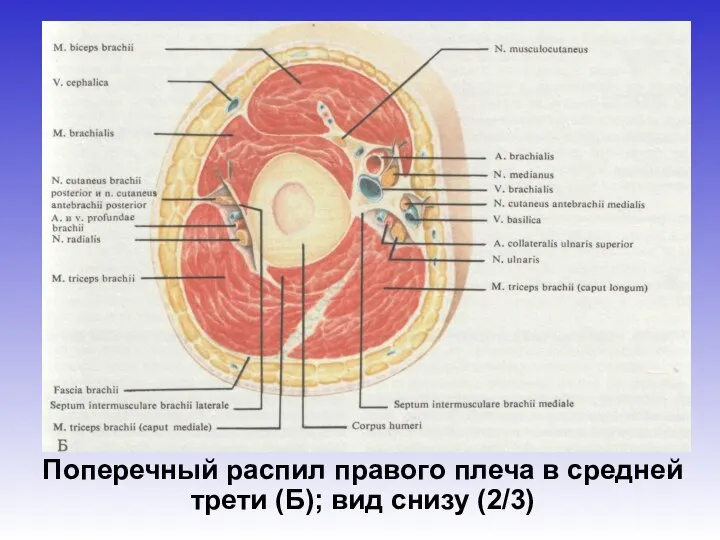 Поперечный распил правого плеча в средней трети (Б); вид снизу (2/3)