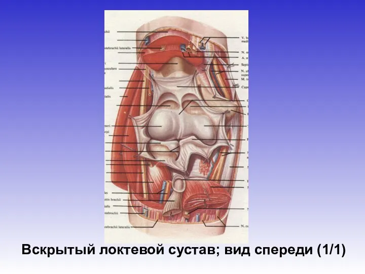 Вскрытый локтевой сустав; вид спереди (1/1)