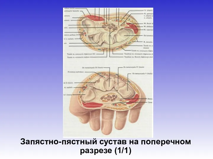 Запястно-пястный сустав на поперечном разрезе (1/1)