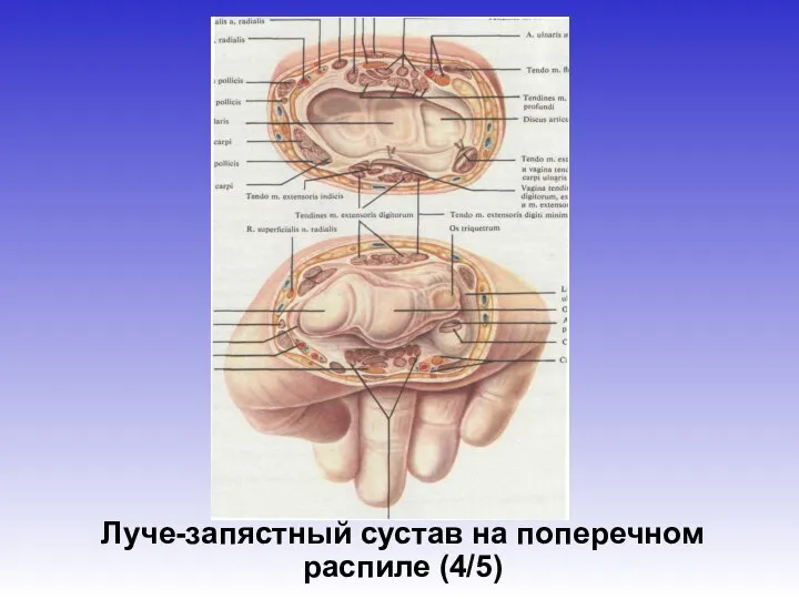 Луче-запястный сустав на поперечном распиле (4/5)