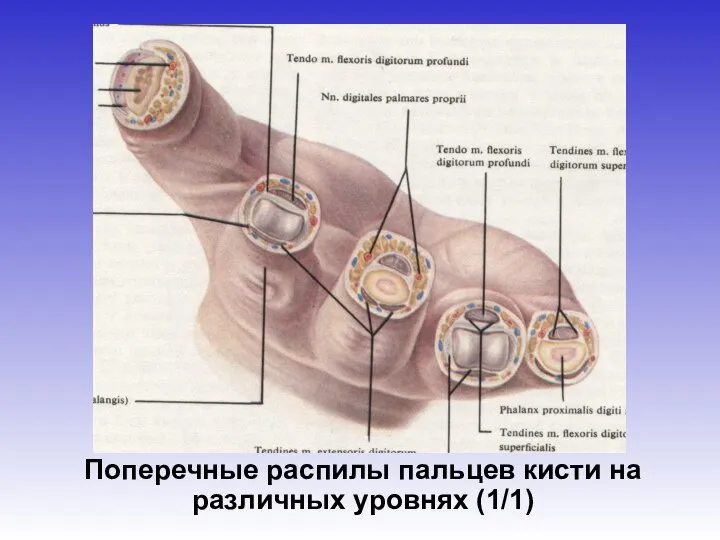 Поперечные распилы пальцев кисти на различных уровнях (1/1)