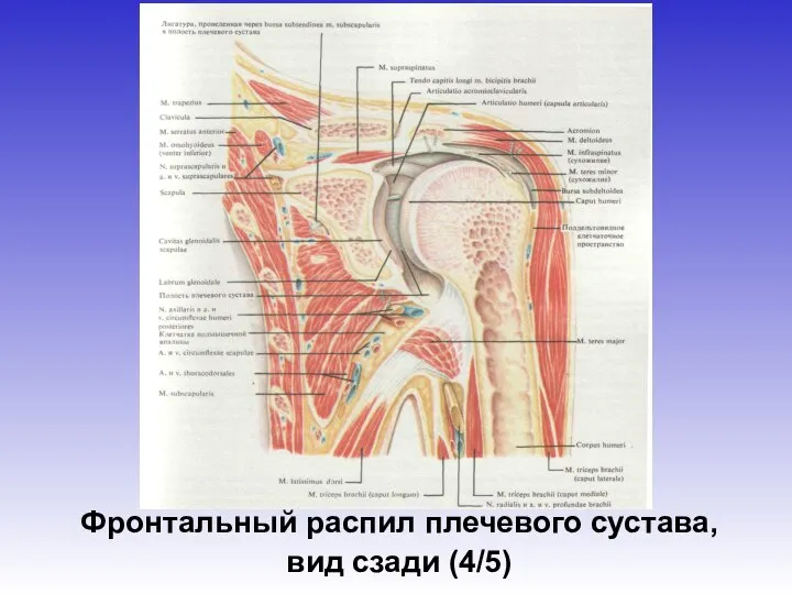 Фронтальный распил плечевого сустава, вид сзади (4/5)