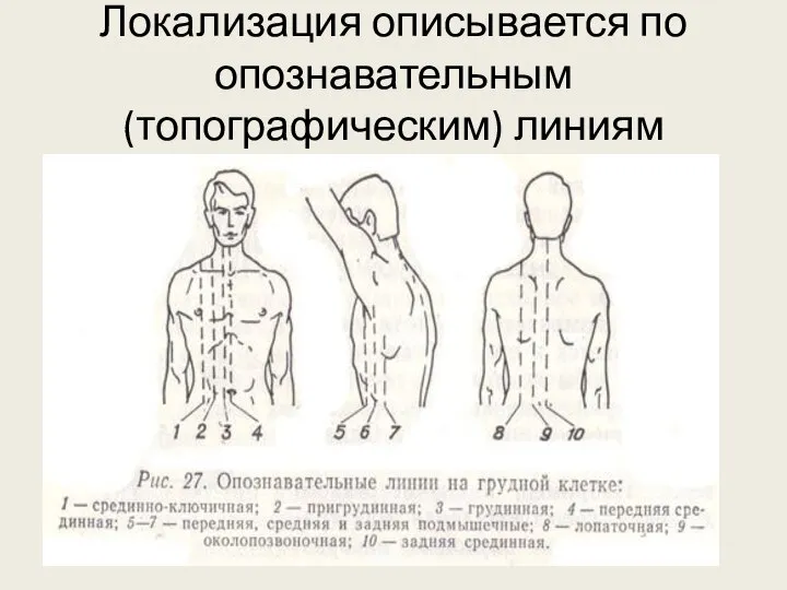 Локализация описывается по опознавательным (топографическим) линиям