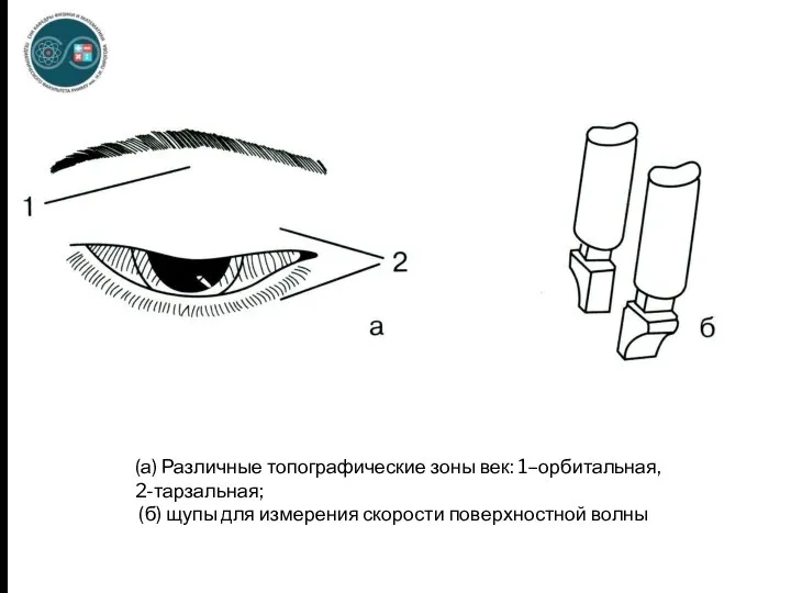 (а) Различные топографические зоны век: 1–орбитальная, 2-тарзальная; (б) щупы для измерения скорости поверхностной волны