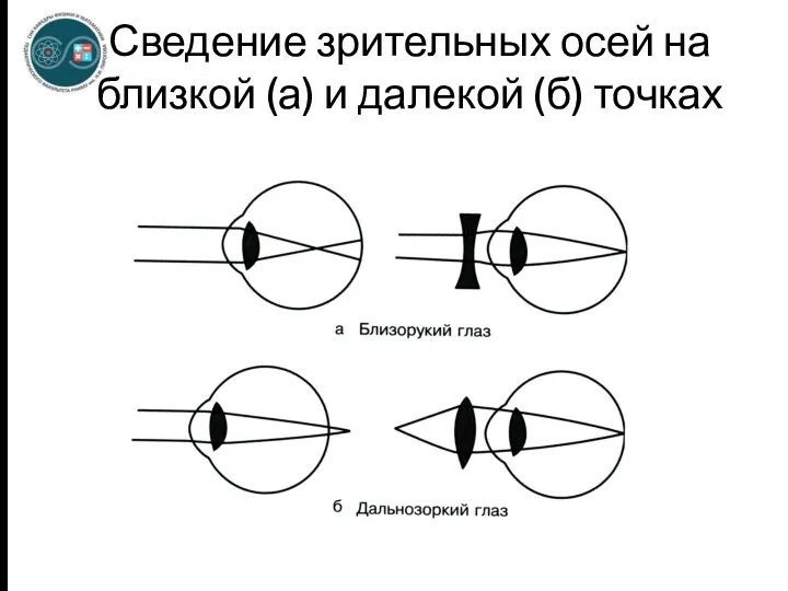 Сведение зрительных осей на близкой (а) и далекой (б) точках