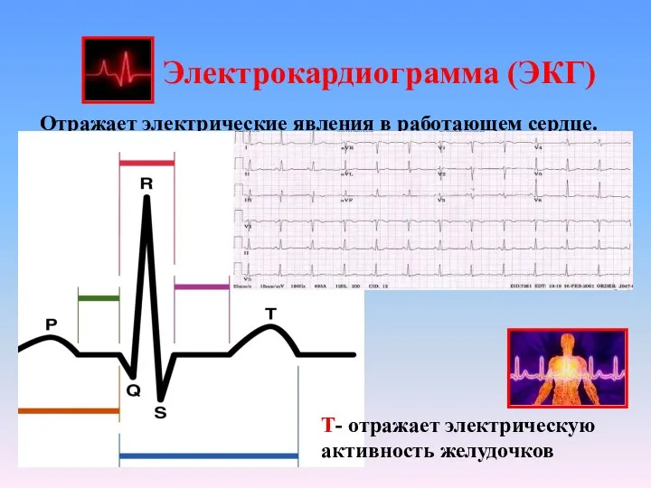 Электрокардиограмма (ЭКГ) Отражает электрические явления в работающем сердце. P- отражает электрическую активность