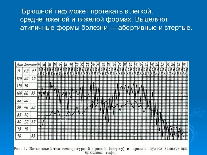 Брюшной тиф может протекать в легкой, среднетяжелой и тяжелой формах. Выделяют атипичные