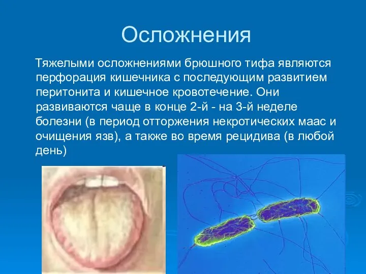 Осложнения Тяжелыми осложнениями брюшного тифа являются перфорация кишечника с последующим развитием перитонита