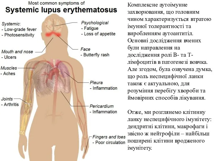 Комплексне аутоімунне захворювання, що головним чином характеризується втратою імунної толерантності та виробленням