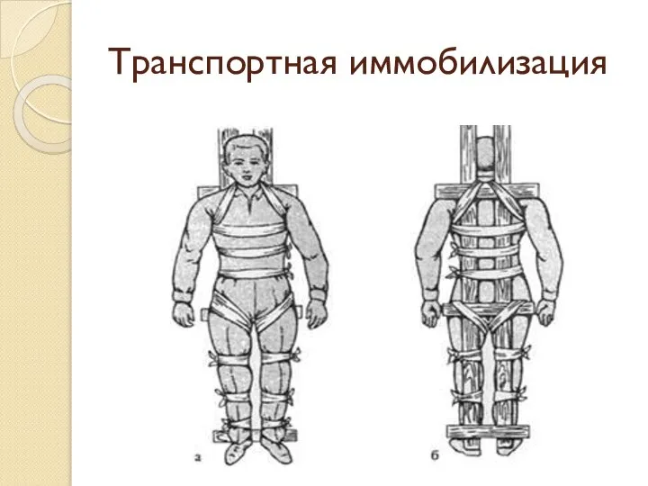 Транспортная иммобилизация