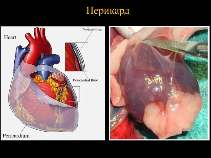 Перикард