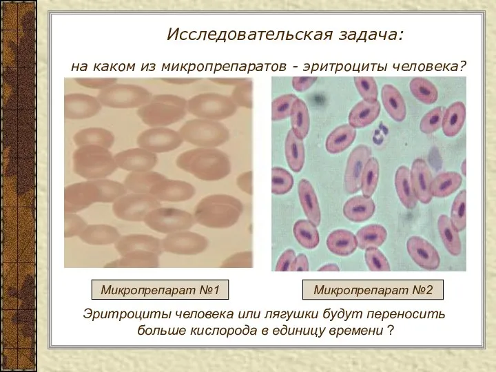 Исследовательская задача: на каком из микропрепаратов - эритроциты человека? Микропрепарат №1 Микропрепарат