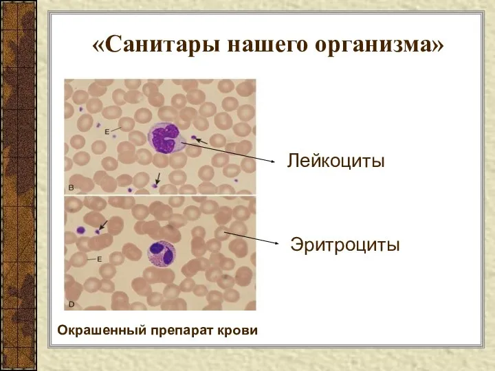 «Санитары нашего организма» Окрашенный препарат крови Эритроциты Лейкоциты