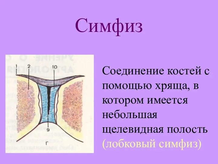 Симфиз Соединение костей с помощью хряща, в котором имеется небольшая щелевидная полость (лобковый симфиз)