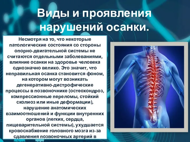 Виды и проявления нарушений осанки. Несмотря на то, что некоторые патологические состояния