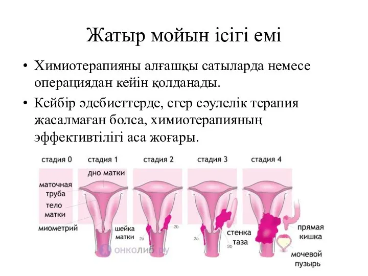 Жатыр мойын ісігі емі Химиотерапияны алғашқы сатыларда немесе операциядан кейін қолданады. Кейбір