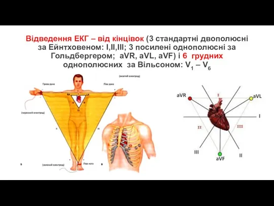 Відведення ЕКГ – від кінцівок (3 стандартні двополюсні за Ейнтховеном: І,ІІ,ІІІ; 3